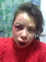 У Пшонки заявляют, что на Черновол напали из хулиганских побуждений