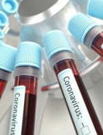 COVID в Украине: 681 больной за сутки и 266 госпитализированных