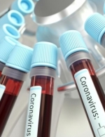 В Украине зарегистрировали 549 больных COVID-19
