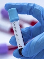COVID: уже 4 633 больных украинцев за сутки
