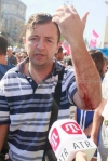 Побитый "Беркутом" "свободовец" попал на операционный стол