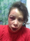 У Пшонки заявляют, что на Черновол напали из хулиганских побуждений