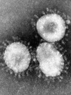 В мире — наибольшее количество заражений и смертей от начала пандемии