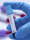 В Украине за сутки более 3,5 тысячи больных COVID-19 и 70 смертей