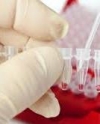 Ученые научились прогнозировать продолжительность жизни