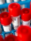За сутки в Украине зафиксировали 617 новых подтвержденных случаев COVID-19