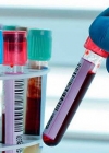 В Украине подтвердили 33 234 случая COVID-19, за сутки - 758
