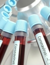 В Украине зарегистрировали 549 больных COVID-19