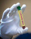 В Украине за сутки - 325 новых случаев COVID-19