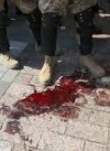 21 военнослужащий из тех, кто пострадал возле Верховной Рады 31 августа, до сих пор на амбулаторном лечении